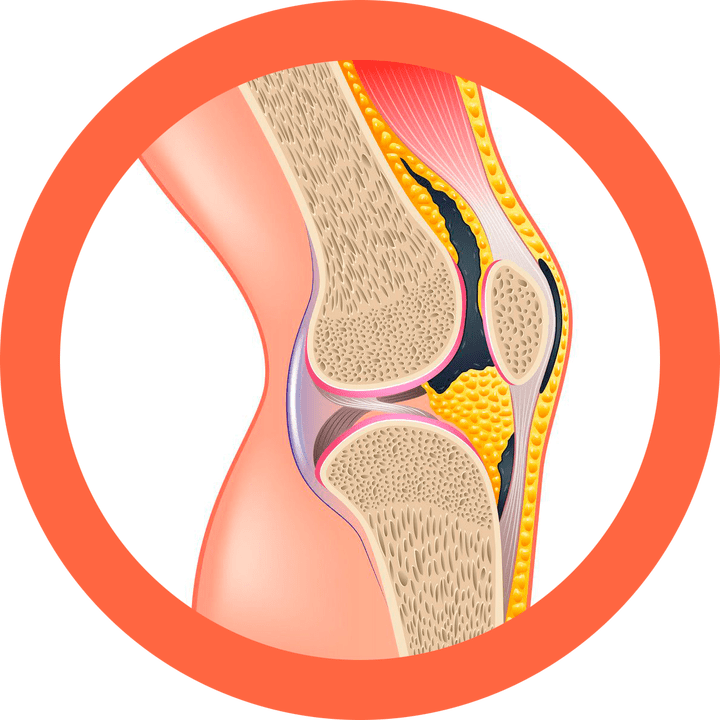Hondroten - herstelt gewrichten en spieren