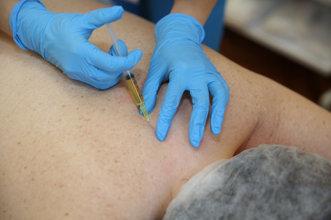 injecties van chondroprotectors voor de rug