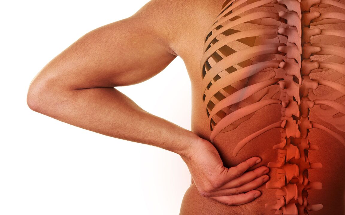 symptomen van lumbale osteochondrose